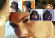 Popular Skin and hair treatments at Ambrosia Clinic,  Hyderabad