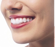 Dental Implants  Hyderabad 