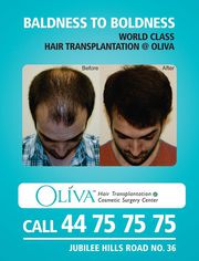 Oliva Hair Transplantation and Cosmetic Surgery Center