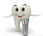 Best Dental Implants at Low Cost in Hyderabad,  India