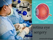 Best retina center in hyderabad|kothapet|sreenetralaya