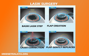 Refractive Services | Economic Lasik Surgery | Lasik eye care