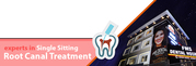 Best Dental Clinic for Root Canal Treatment & Cost in Hyderabad