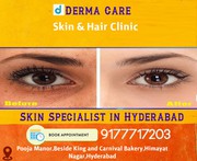 Top Pimple Treatment in Himayat Nagar Hyderabad  | Derma Care Clinic