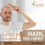 Best Hair Transplant in Hyderabad