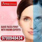 Best skin treatment with affordable cost and guranteed results