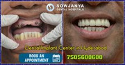 Dental Implants in Hyderabad | Best Cosmetic Dentist in Hyderabad