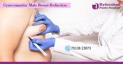  Best Gynecomastia Surgery in Hyderabad