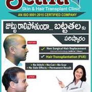   Best hair transplant in Hyderabad