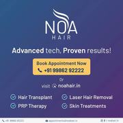 Noa Hair & Skin Clinic | face pigmentation treatment Kadapa