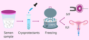 Semen Freezing - Test Tube Baby Centre in Kurnool