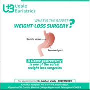 Best Sleeve Gastrectomy Surgery in Hyderabad | Ugale Bariatrics