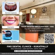Best Dental clinic in Kukatpally KPHB