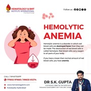  Expert Care for Anemia by Dr. S.K. Gupta: Your Trusted Anemia Special
