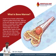  Bone marrow transplant in Hyderabad—Dr. SK Gupta