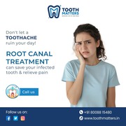 Expert Root Canal Treatment at Tooth Matters