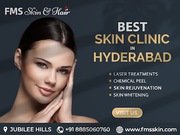 best cosmetic skin clinic in jubilee hills